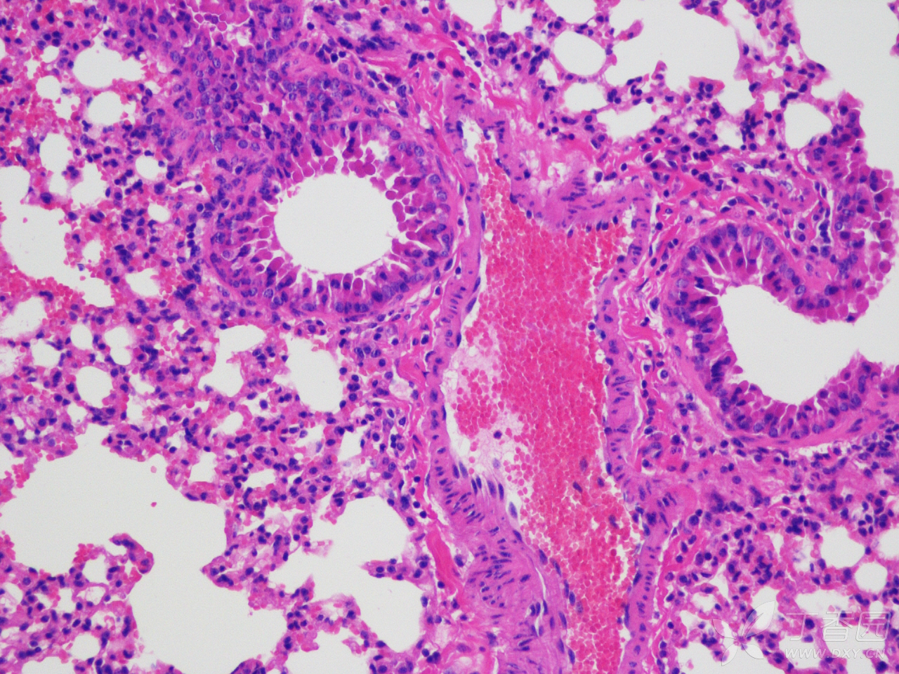 小鼠肝脏HE染色病理切片分析 - 生理生化与组织胚胎 -丁香园论坛