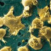 干细胞：间充质干细胞、胚胎干细胞、iPS