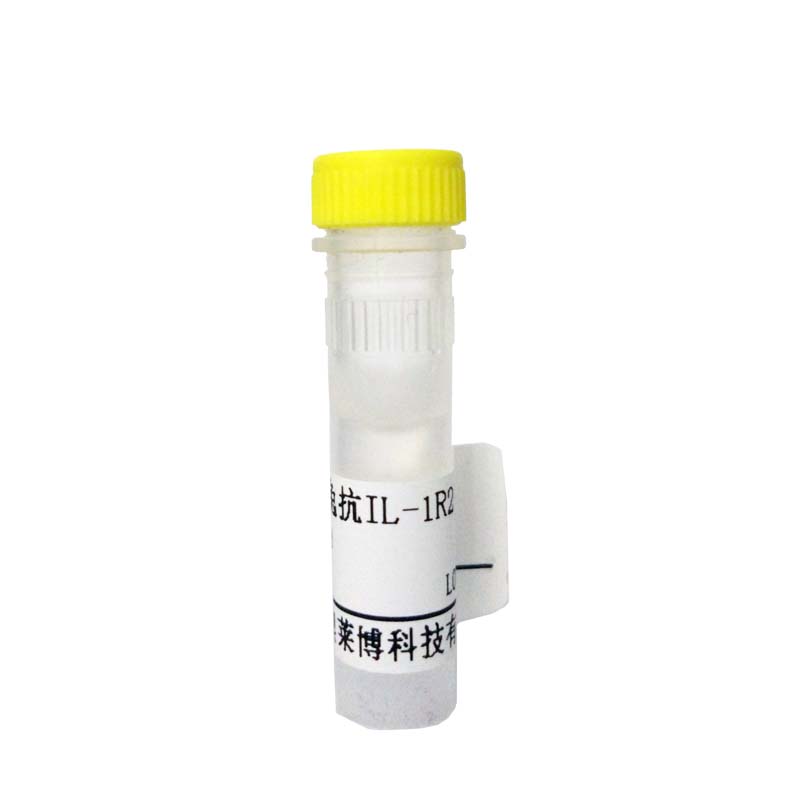 K21322型Neuropilin 2抗体现货供应
