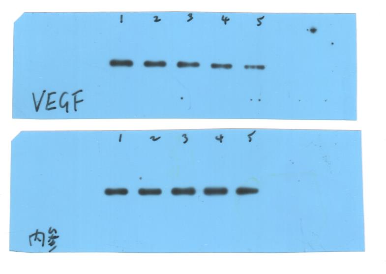 western blot蛋白免疫印迹检测