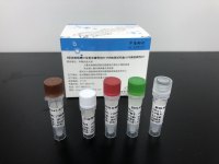 禽流感病毒通用型实时荧光RT-PCR检测试剂盒