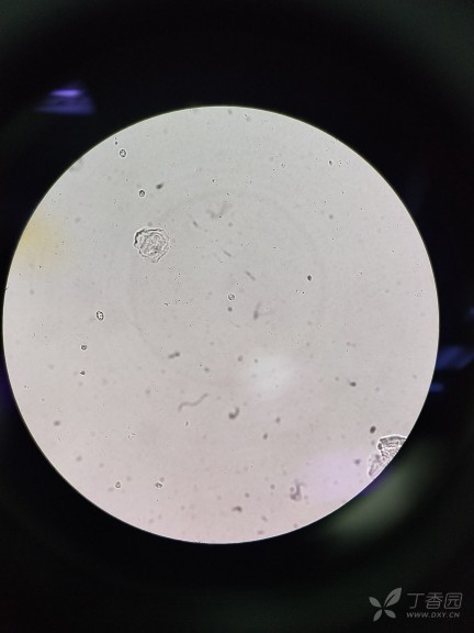 这应该是皱缩红细胞吧 - 标签数据维护版块 -丁香园论坛