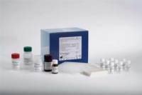 人纤溶酶原激活剂检测试剂盒价格
