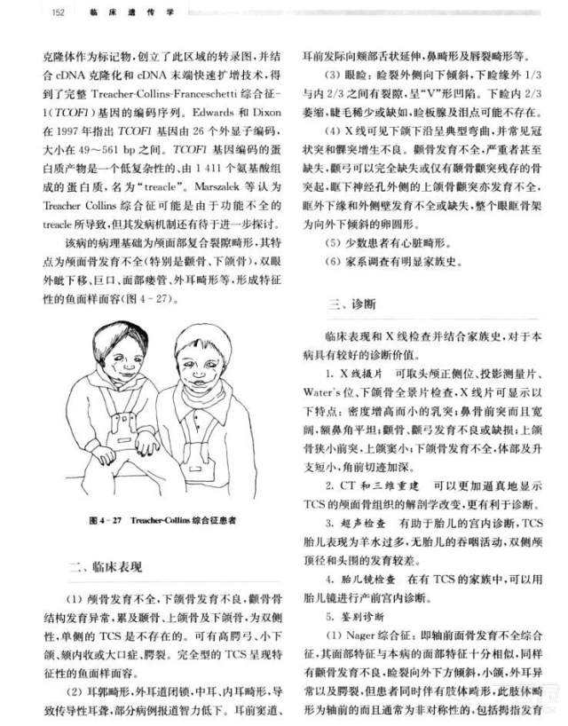 鸟面综合症原因是什么图片