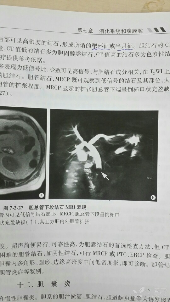 医学影像学考研