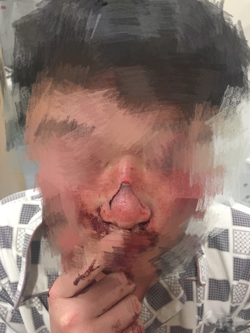 3252382309420584951-16w.jpg