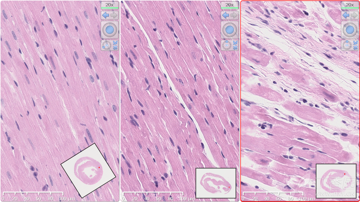 心脏HE染色图片