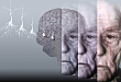 脑深部电刺激治疗阿尔茨海默病的初步探索（上）