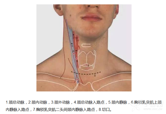 颈总动脉和胸锁乳突肌图片