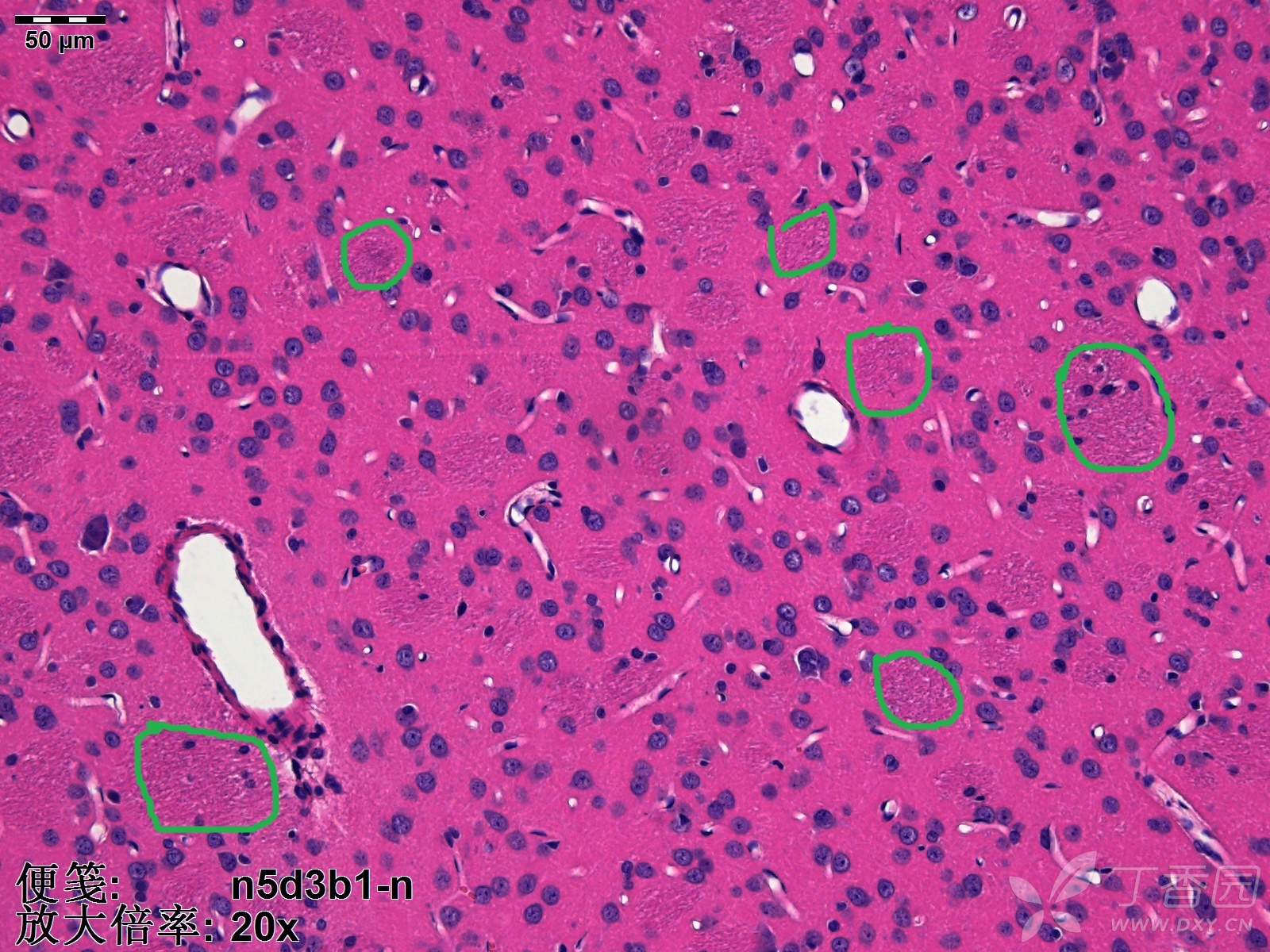he染色,纹状体(尾壳核,cpu)区域可见一块一块的淡染色区域,请问是什么