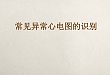 常见异常心电图识别 这份幻灯不可不看