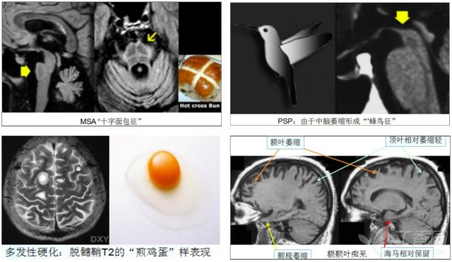 图文并茂轻松掌握压疮分期 图文并茂：轻松掌握头颅影像解剖