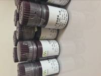 白蛋白检测试剂盒(溴绿比色法)