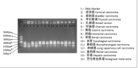 超高保真DNA文库制备试剂盒 Ultra HiFi DNA Library Kit