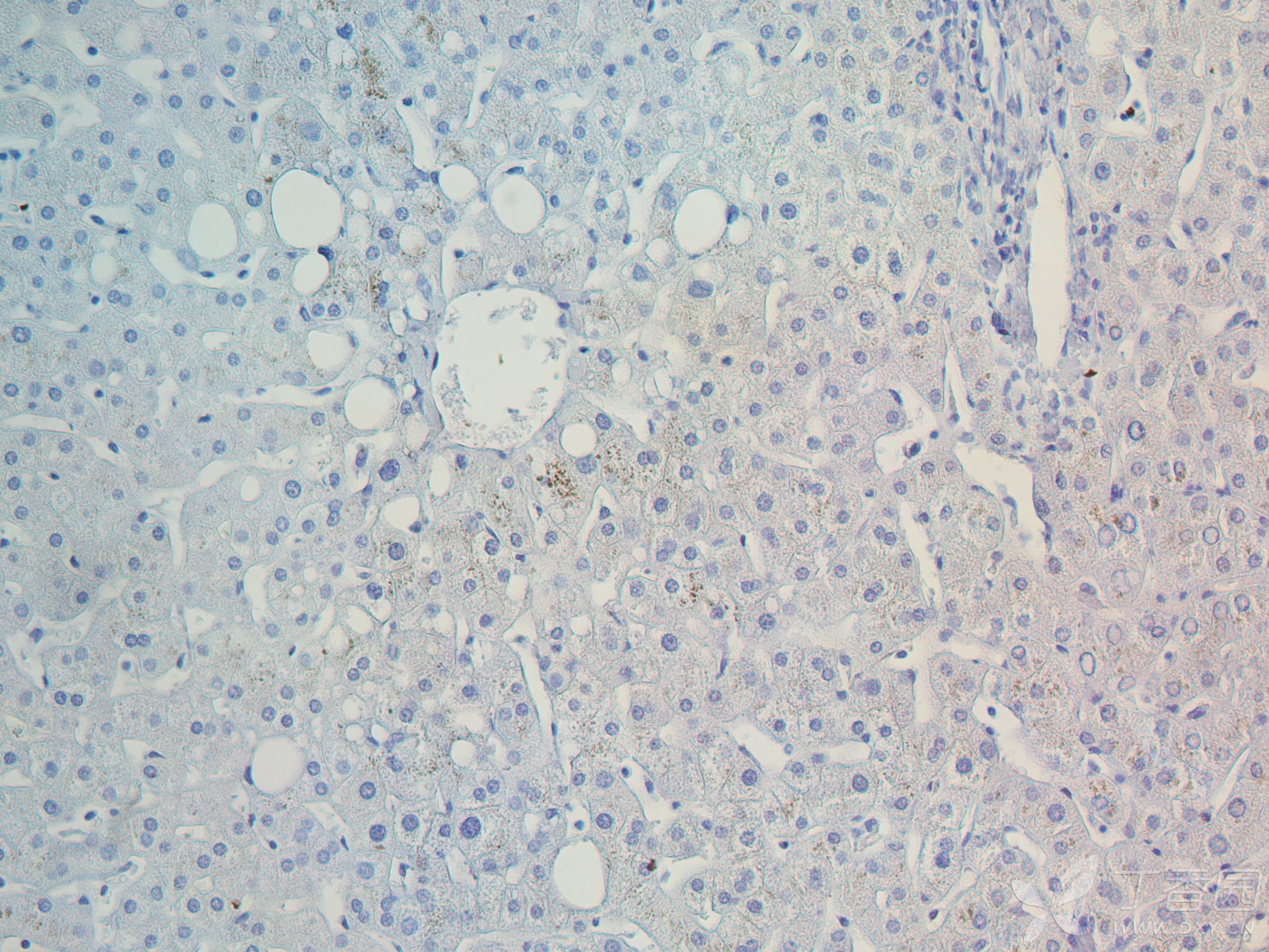 最近在做一些人肝组织的免疫组化染色,连续做了三次,抗体浓度和dab