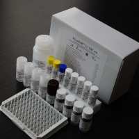 21-羟化酶抗体 21-OH Ab 检测试剂盒