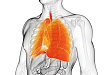 FDA 批准阿法替尼用于 3 种新突变 NSCLC 患者