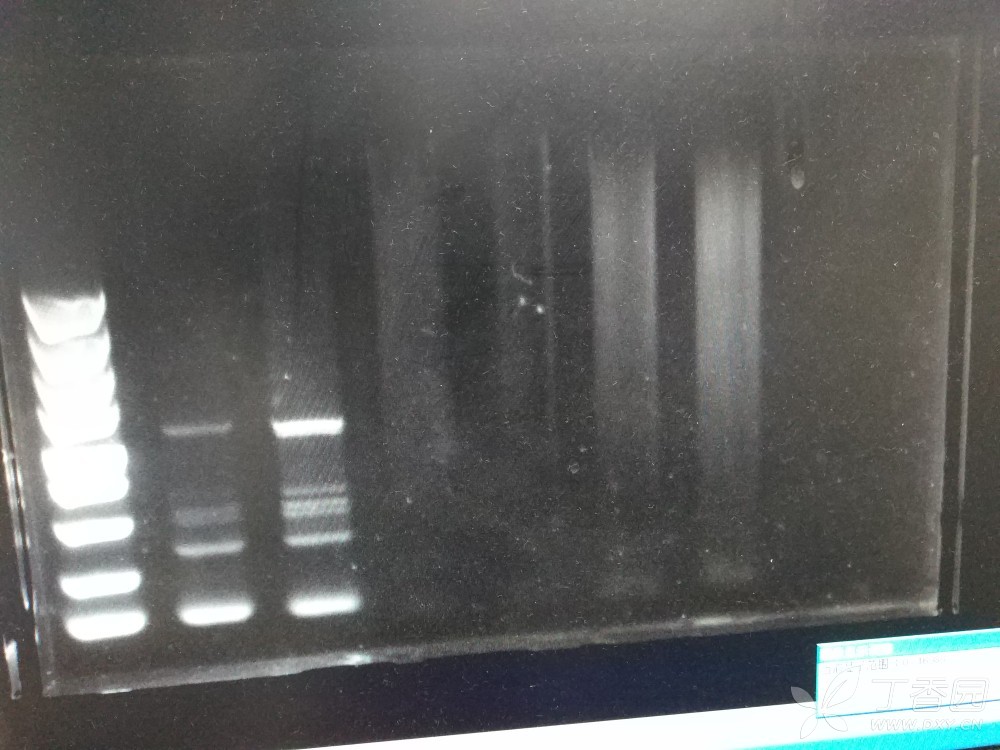 反轉錄cdna做pcr 電泳泳道彌散