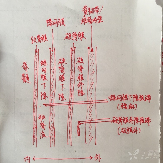 椎管内麻醉平面图片