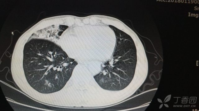 3256648436011100098-16w.jpg!w640