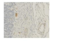 Anti-α-calcitonin gene-related peptide (α-CGRP)