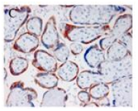 Anti-Pregnancy associated plasma protein A (human, PAPP-A)