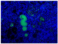 Anti-Complement component C1s (human, pro- and activated enzyme)