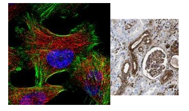 Anti-Gelsolin (human)