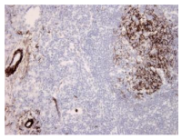 Anti-Complement component C5b-9 (human)