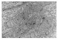 Anti-Doublestranded DNA