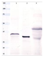 Anti-Gliadin peptide
