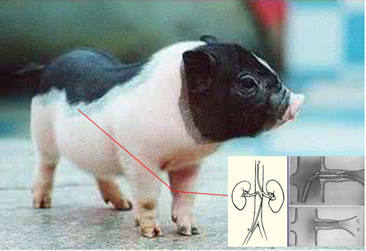 小型猪肾动脉狭窄模型制备