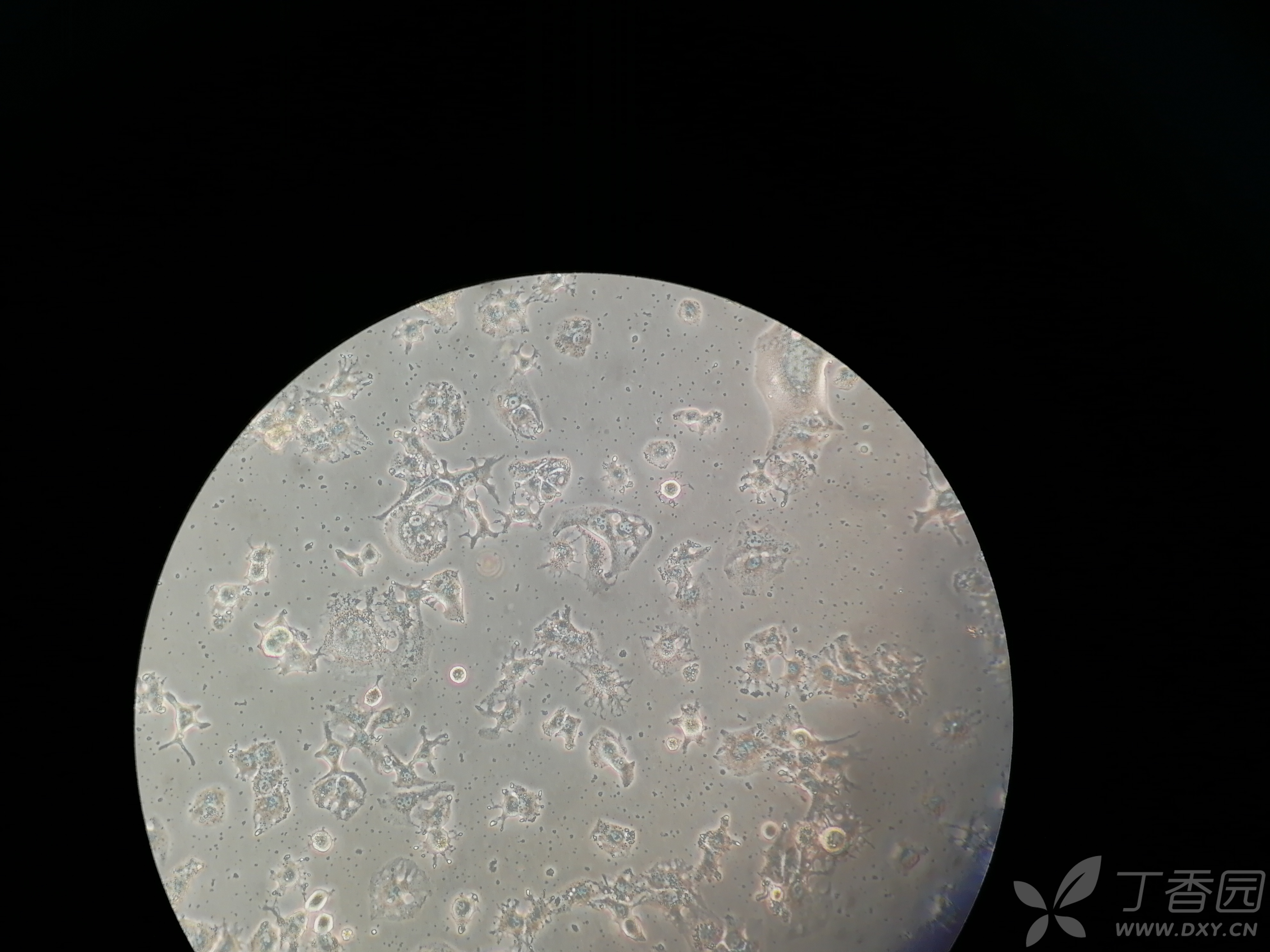 huh7培养过程中出现小黑点 - 细胞技术讨论版 -丁香园论坛