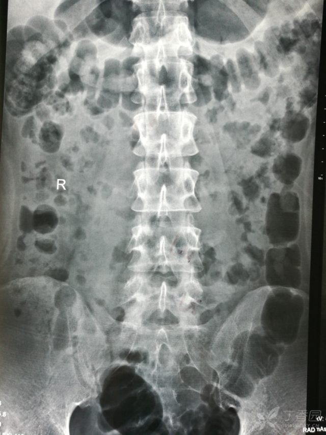 3258214187814027584-16w.jpg!w640