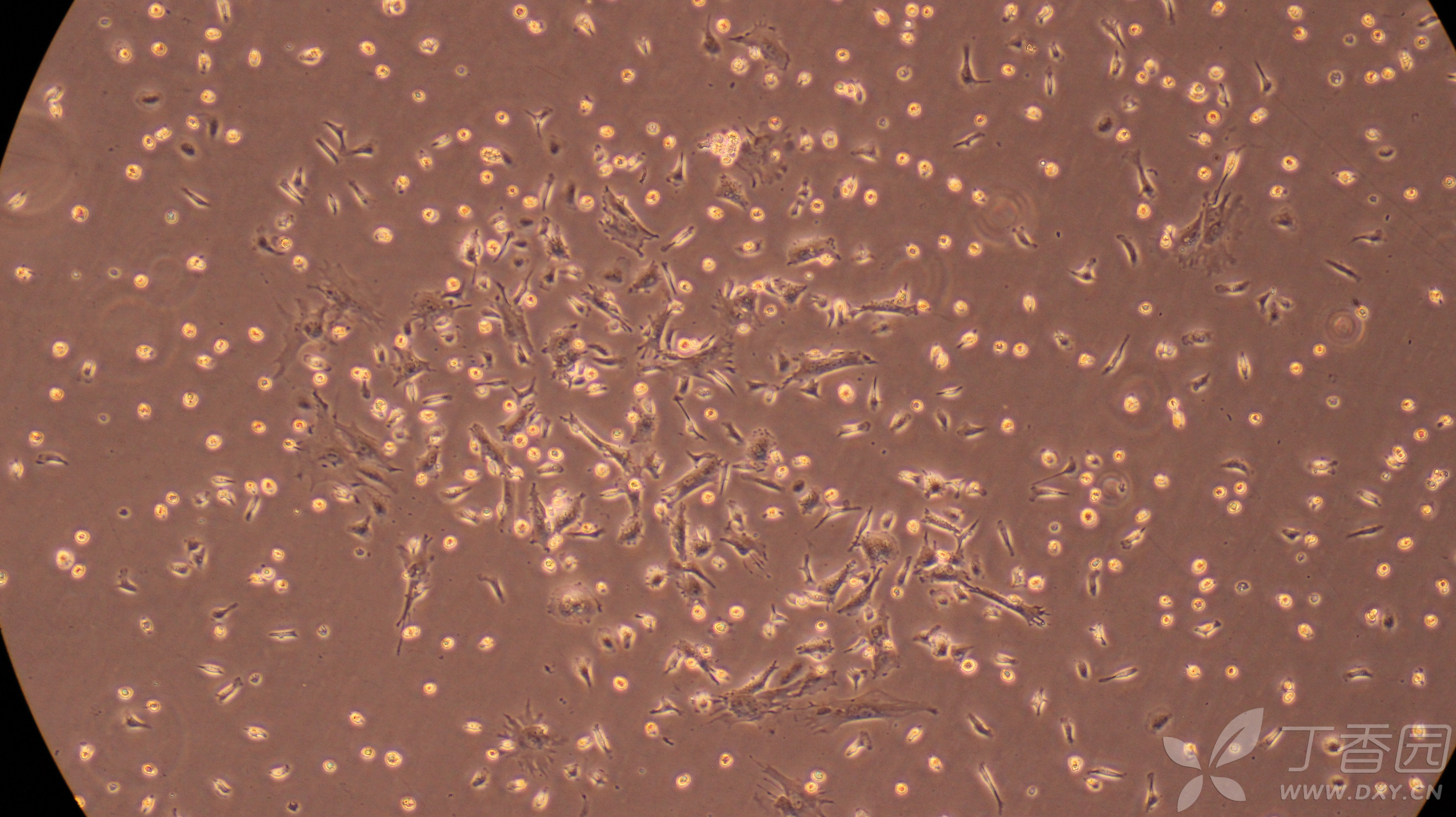 间充质干细胞形态图片