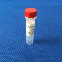 β2-微球蛋白(β2-MG)单克隆抗体