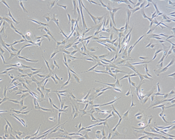 脐带间充质干细胞