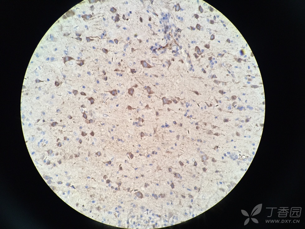 brdu标记的大鼠脑组织,为什么染色在胞浆啊?求大神帮忙啊!