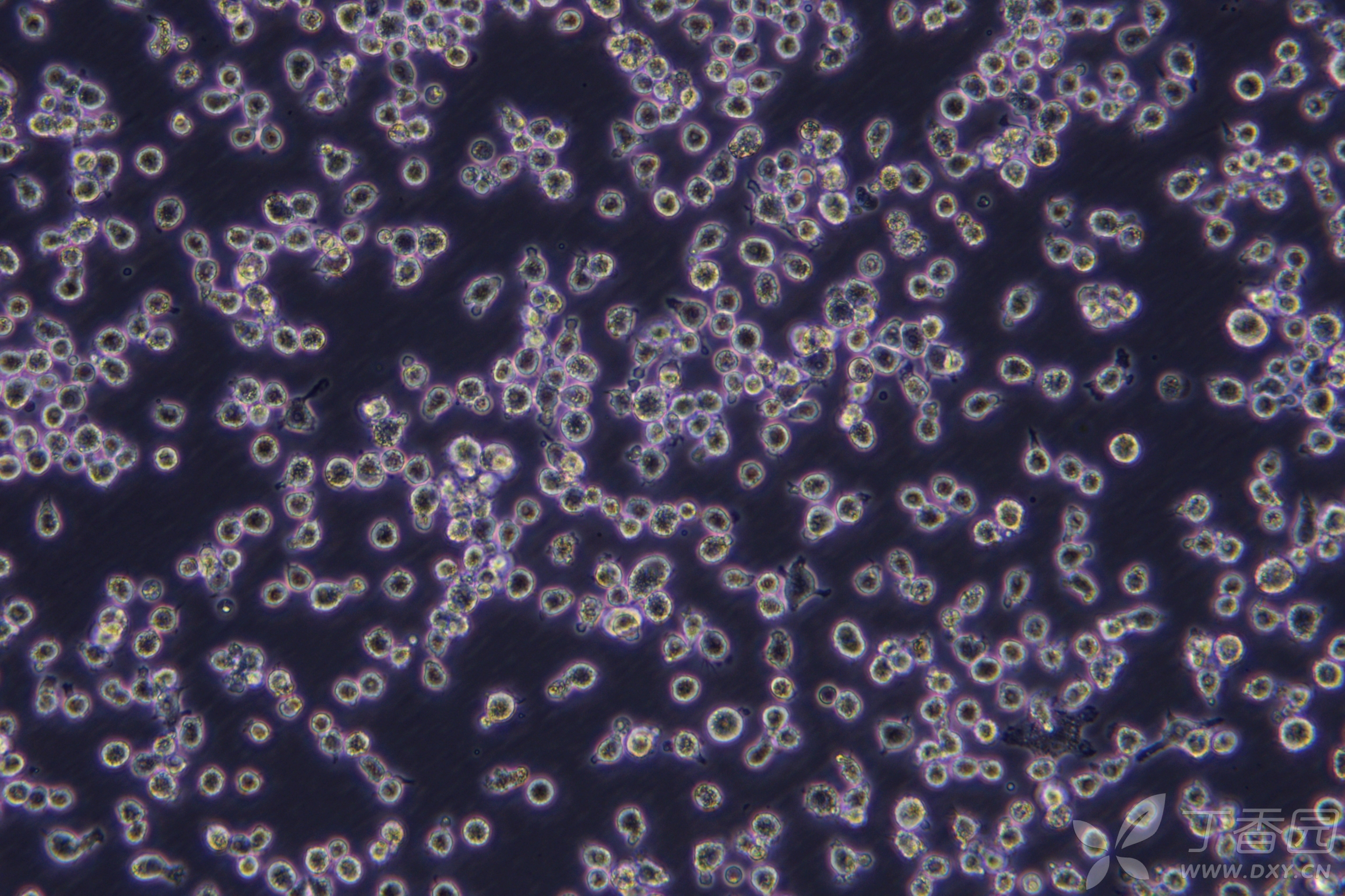 台盼蓝颗粒巨噬细胞图片