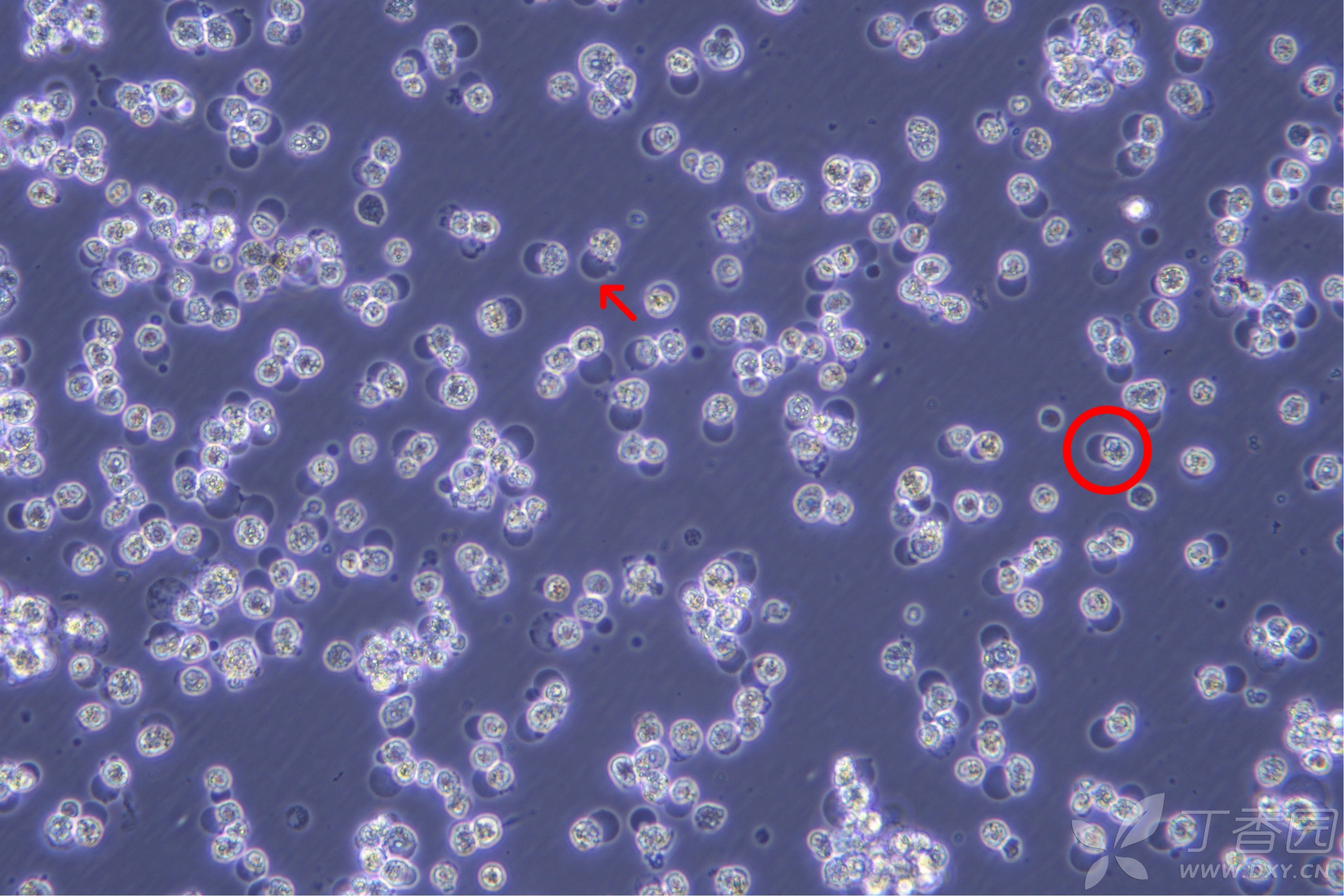 台盼蓝颗粒巨噬细胞图片