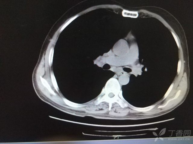 3262377677570916388-16w.jpg!w640