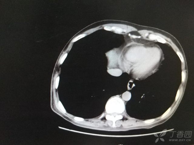 3262377684013367382-16w.jpg!w640