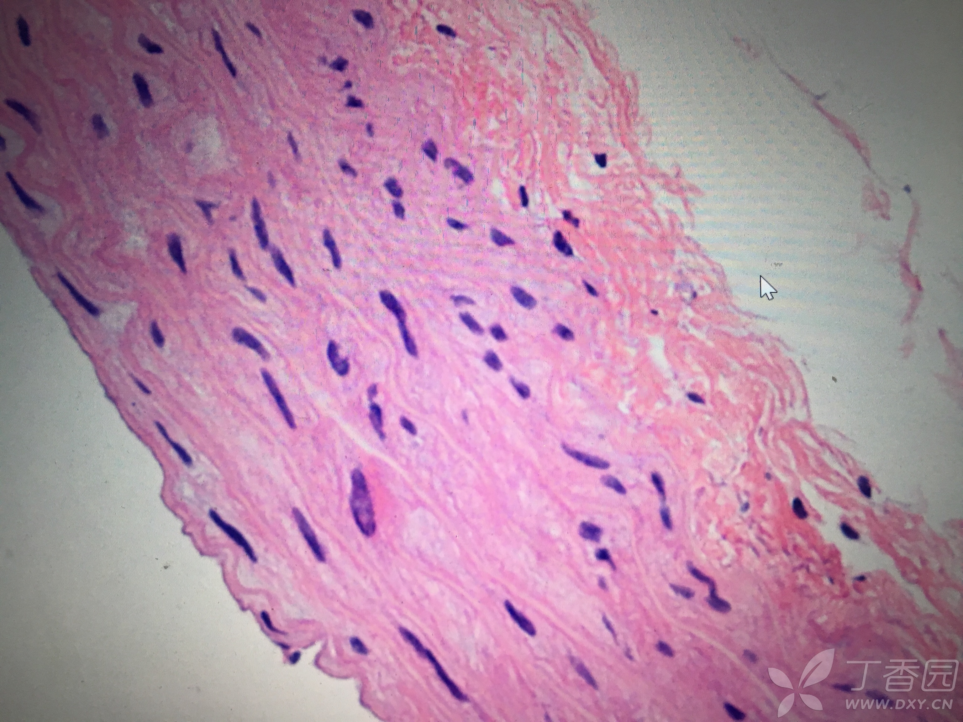 平滑肌细胞显微镜图片