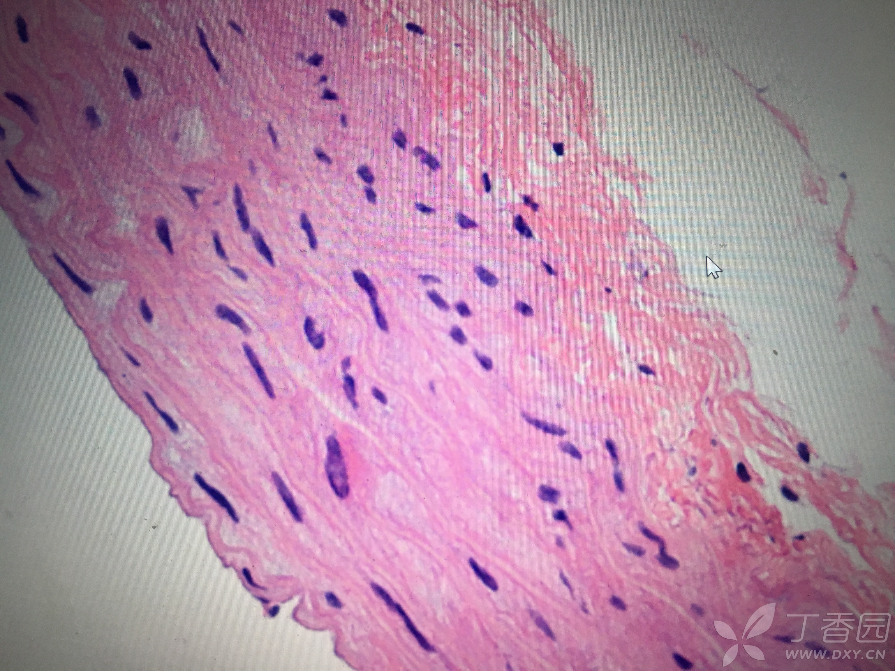 血管平滑肌病理切片观察