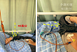 患者未按时服药，是宣教不到位吗？