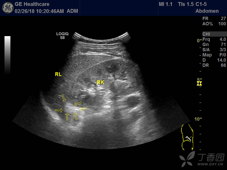 超声医学 - 专业医生社区,医学,药学,生命科学,科研学术交流