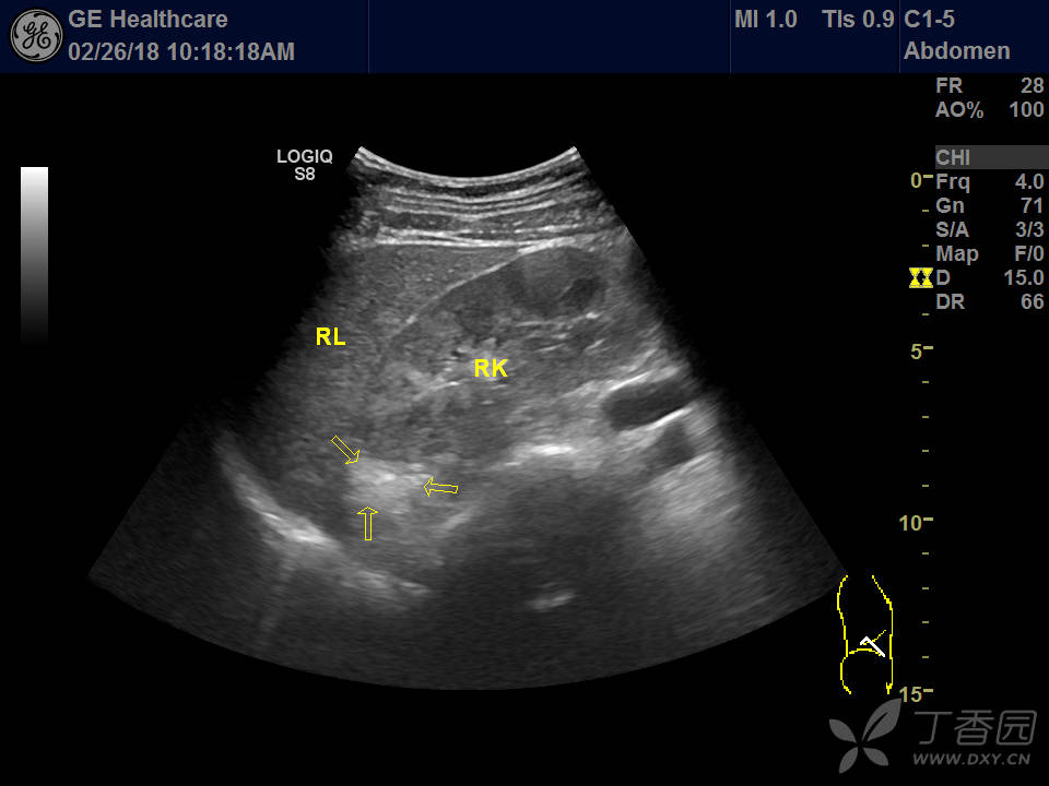 超声医学 - 专业医生社区,医学,药学,生命科学,科研学术交流