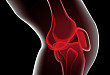 膝关节运动损伤的 3 种影像学表现，你都知道吗？