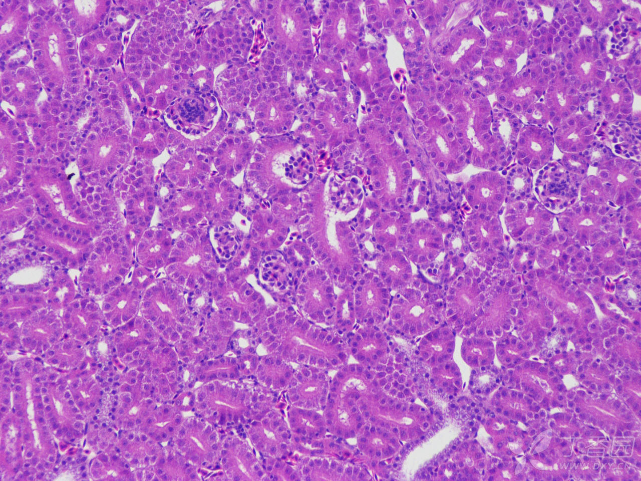 鸡肝癌细胞图片大全图片