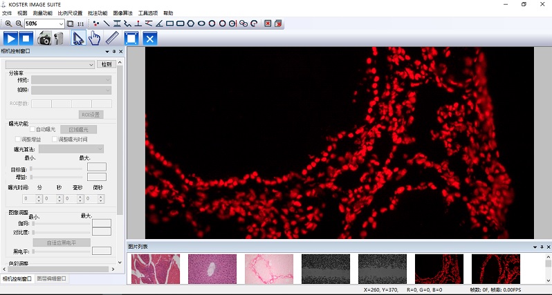 生物顯微圖像分析軟件KOSTER IMAGE SUITE